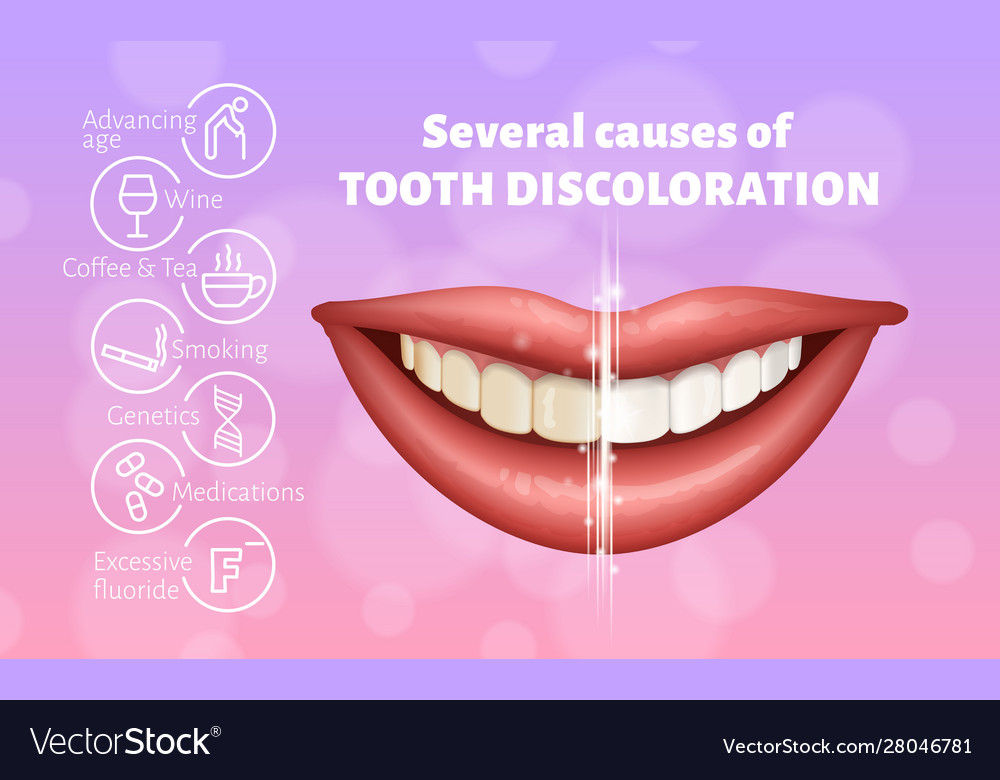 Medical poster showing causes tooth