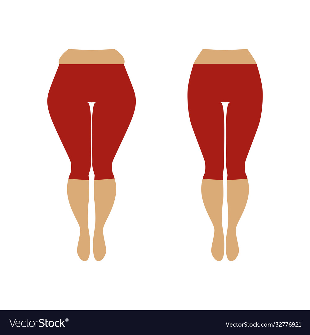 Fat and slim womans hip a woman with cellulite Vector Image Fat and slim womans hip a woman with cellulite