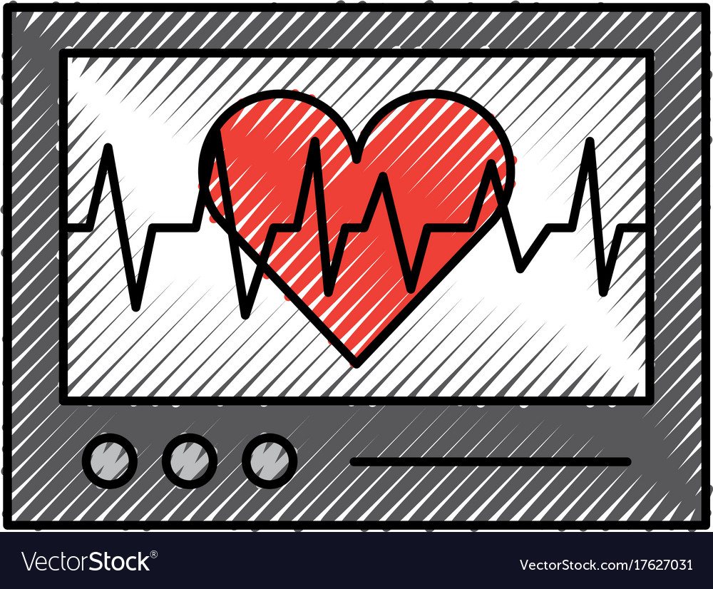 Ecg machine displaying heartbeat monitoring