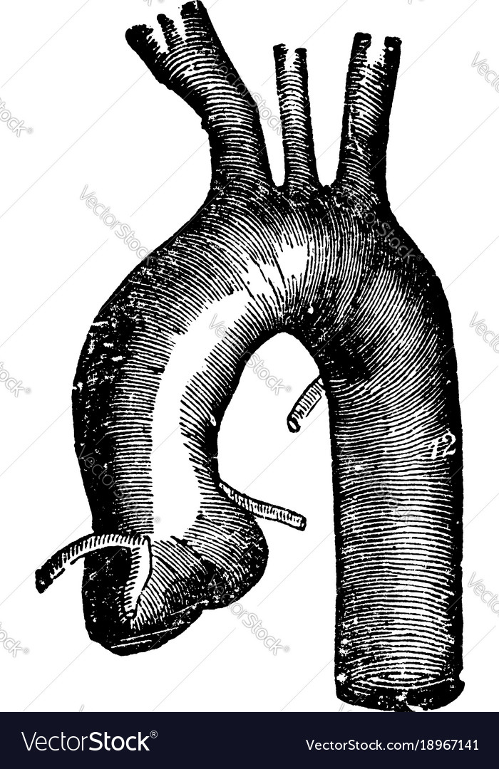 Vintage Anatomical Diagram – Thoracic Aorta