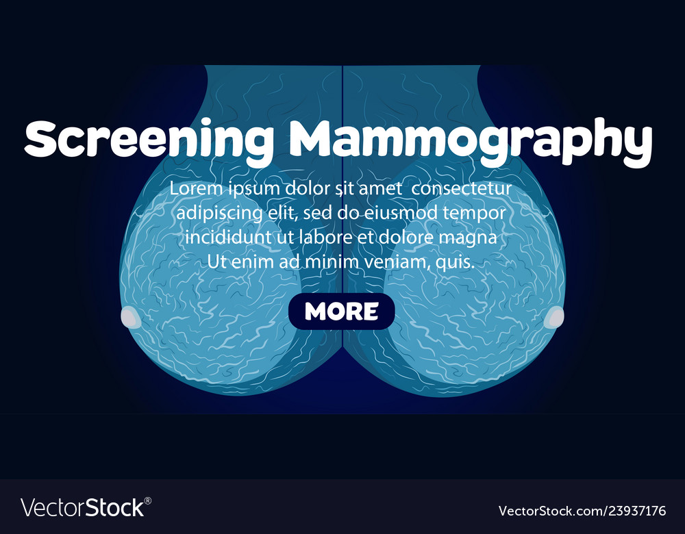 Screeningl Mammography Banner Royalty Free Vector Image