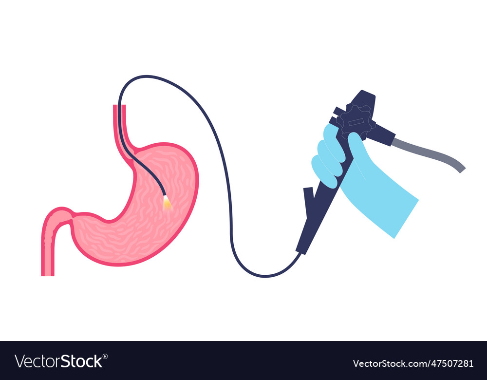 Gastroscopy Endoscopy Procedure Royalty Free Vector Image