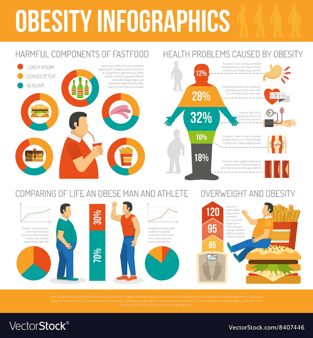 Obesity Concept Infographic Royalty Free Vector Image