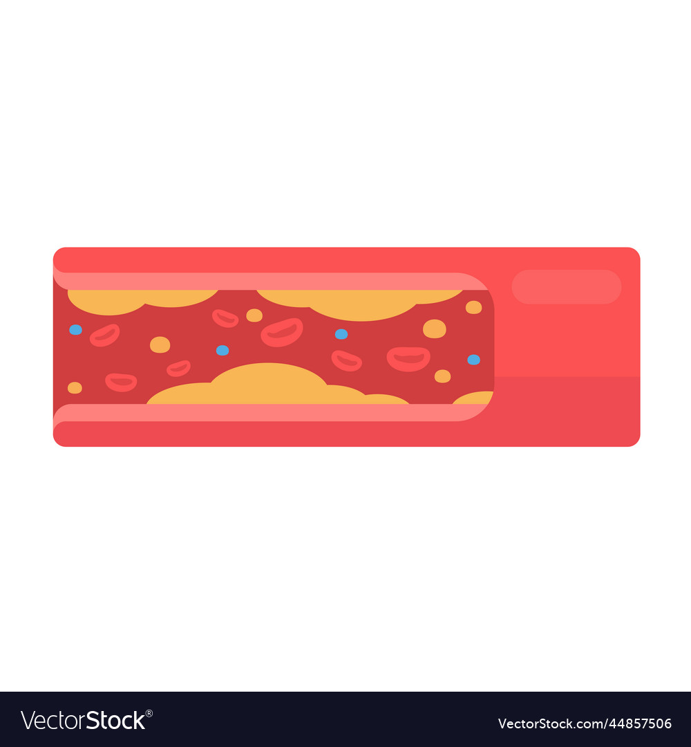 Coronary arteries with accumulated fat in the body