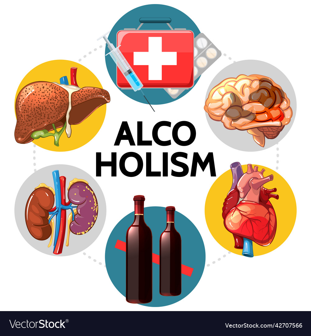 Cartoon alcoholism bad effects concept Royalty Free Vector