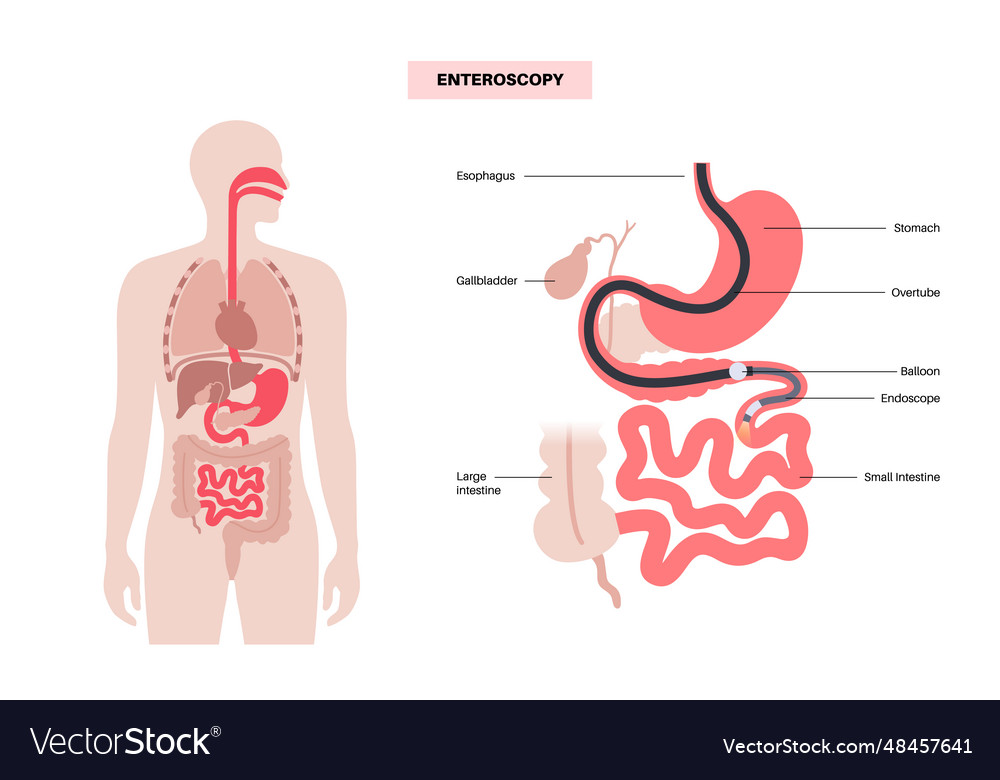 Double balloon enteroscopy