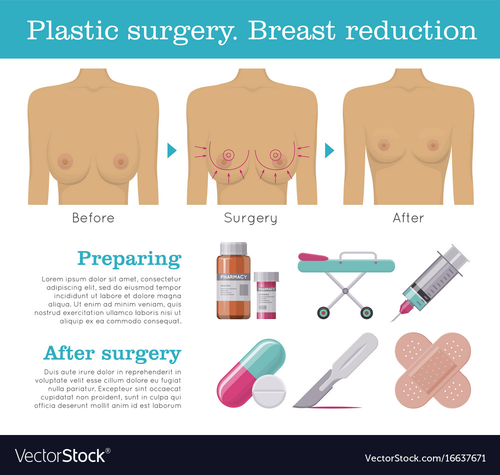 free plastic surgery breast