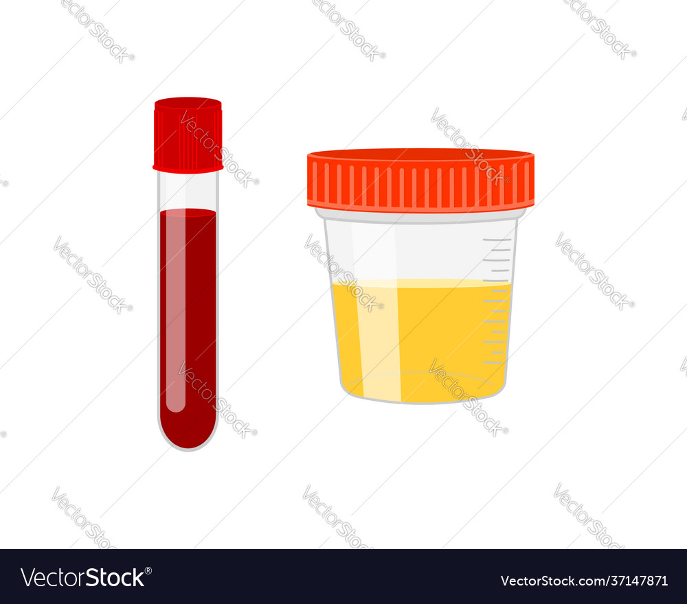 Test tube with blood and urine sample container