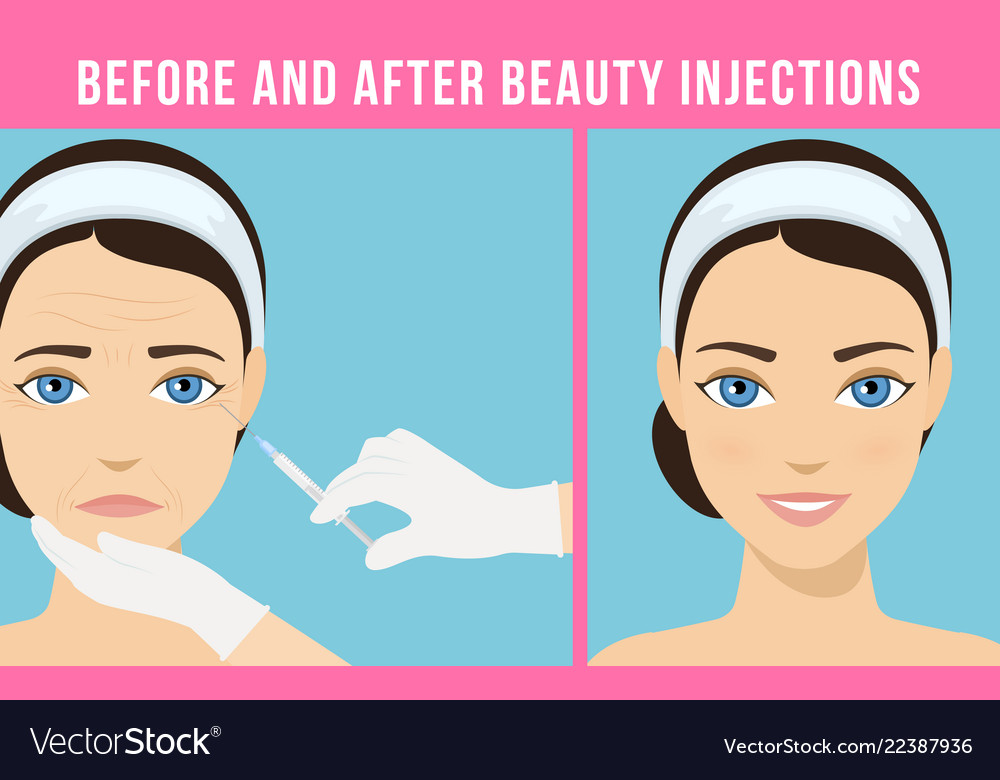 Cosmetic procedures botox Royalty Free Vector Image