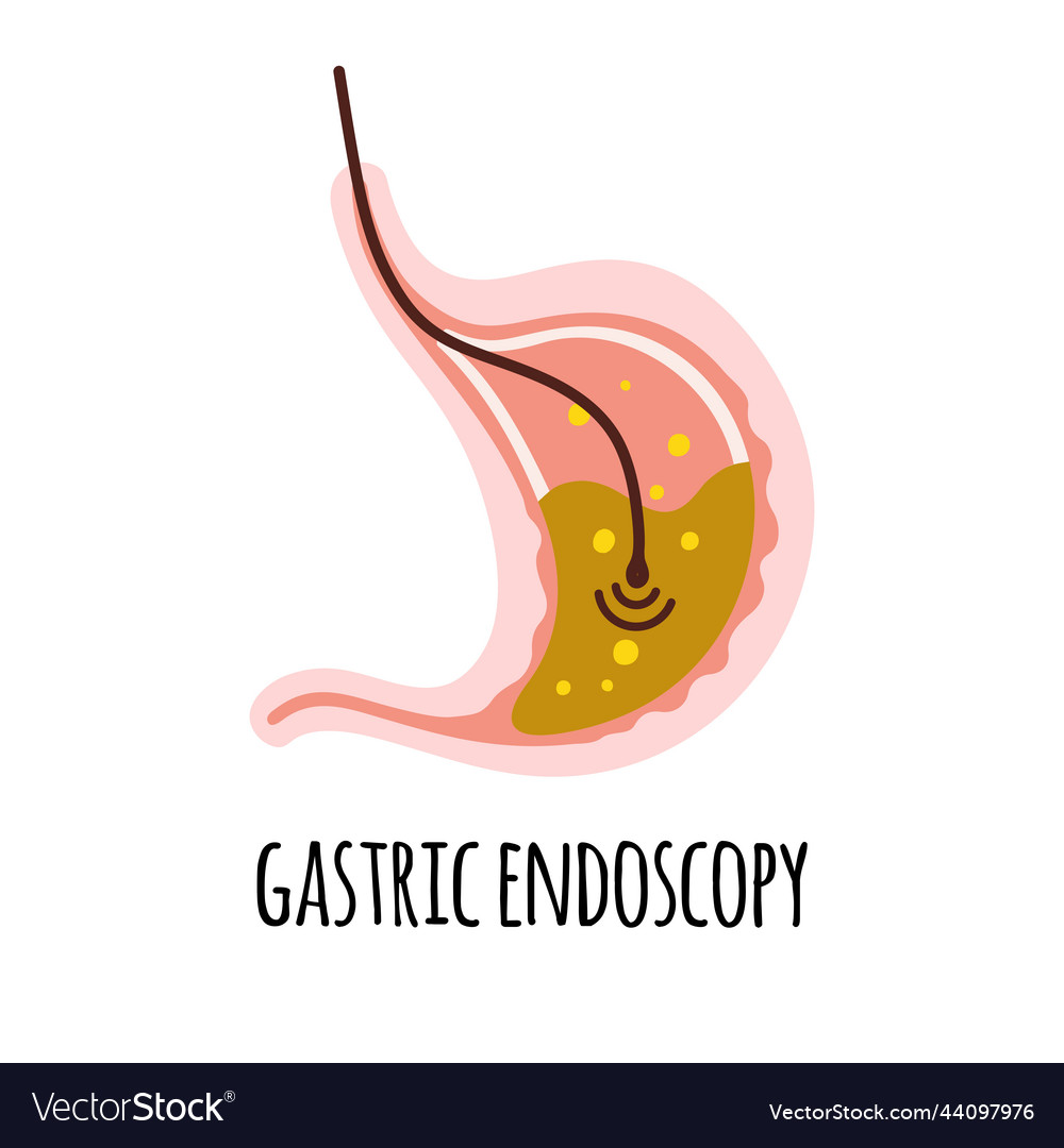 Endoscopy the stomach of a person with high Vector Image