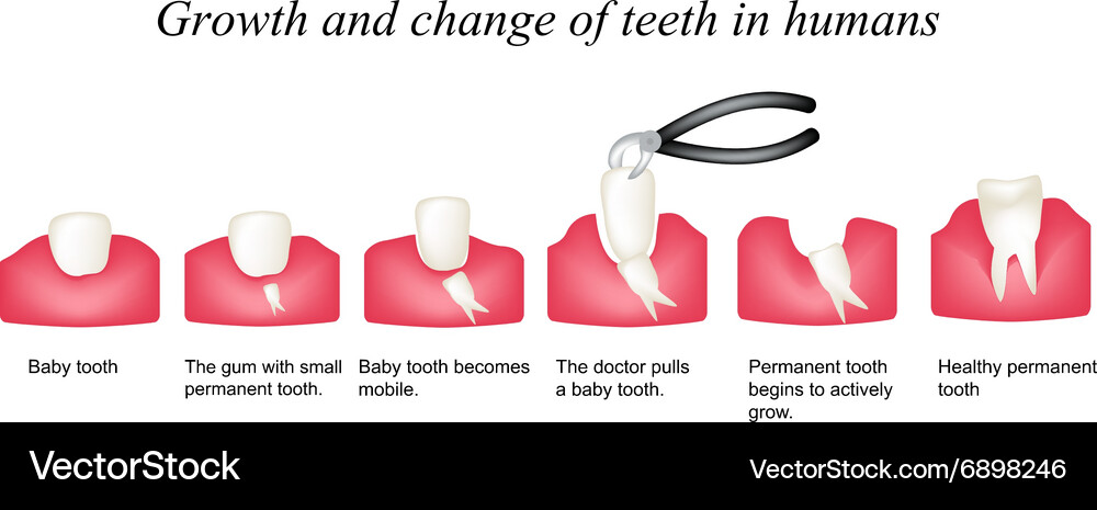 Growth and shift teeth in humans Stages of Vector Image