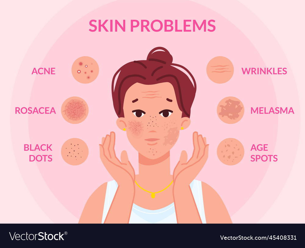 types-skin-problems-woman-face-with-skins-vector-image