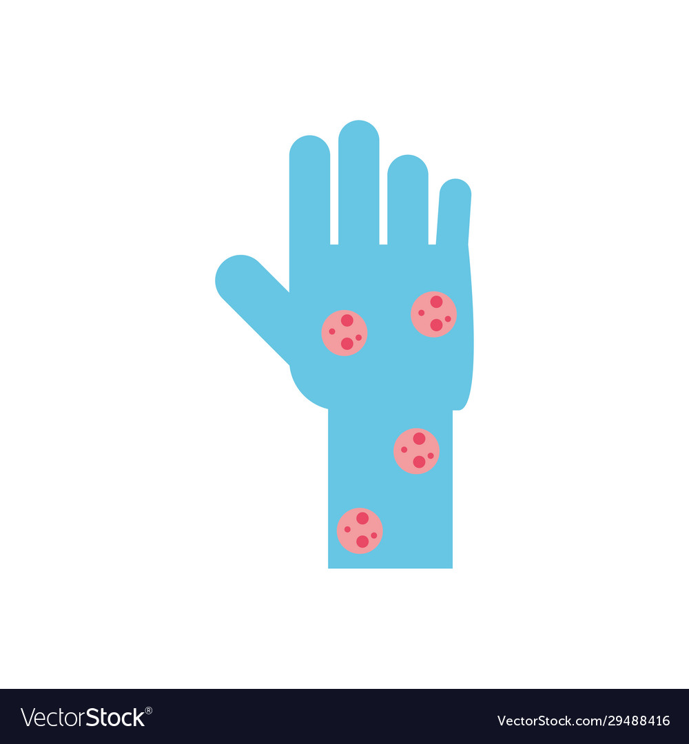 Hand with varicella flat style icon