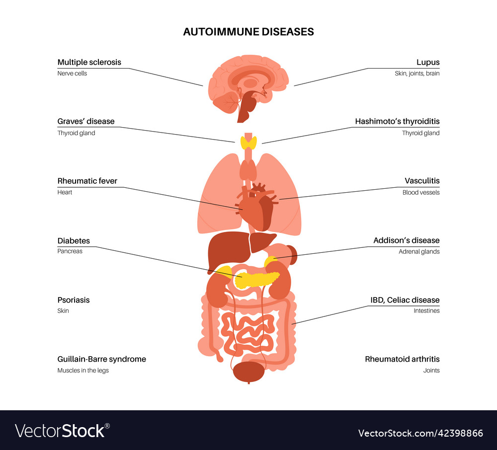 Autoimmune disorders diseases