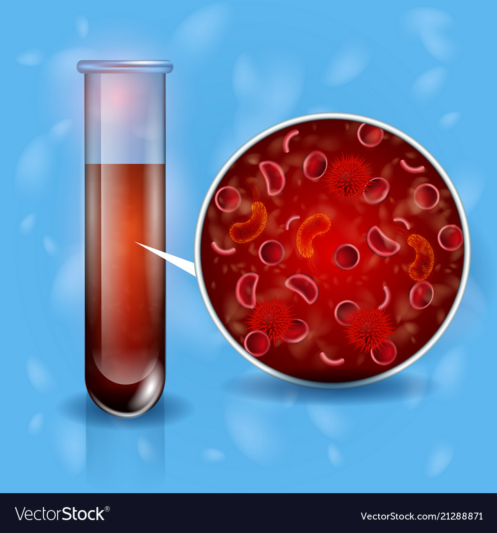 Sick Human Blood Analysis
