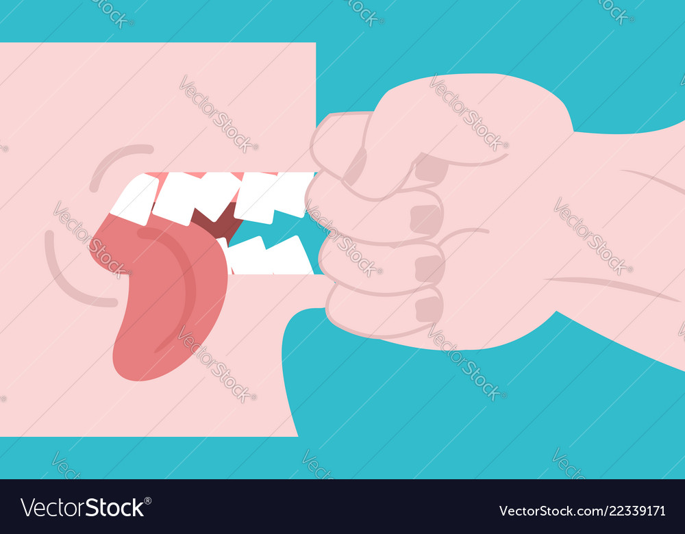 Schlag auf Zähne Faust im Gesicht zu schlagen gebrochen