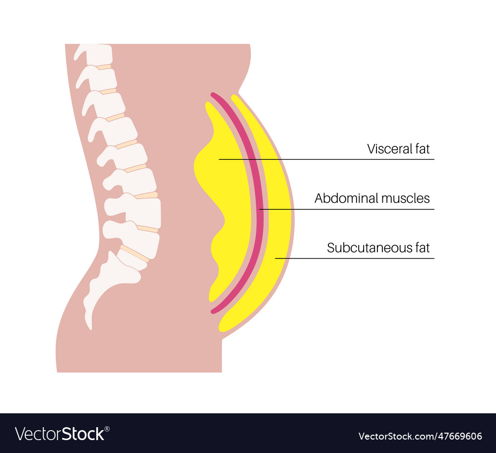 Viszerales Fettdiagramm