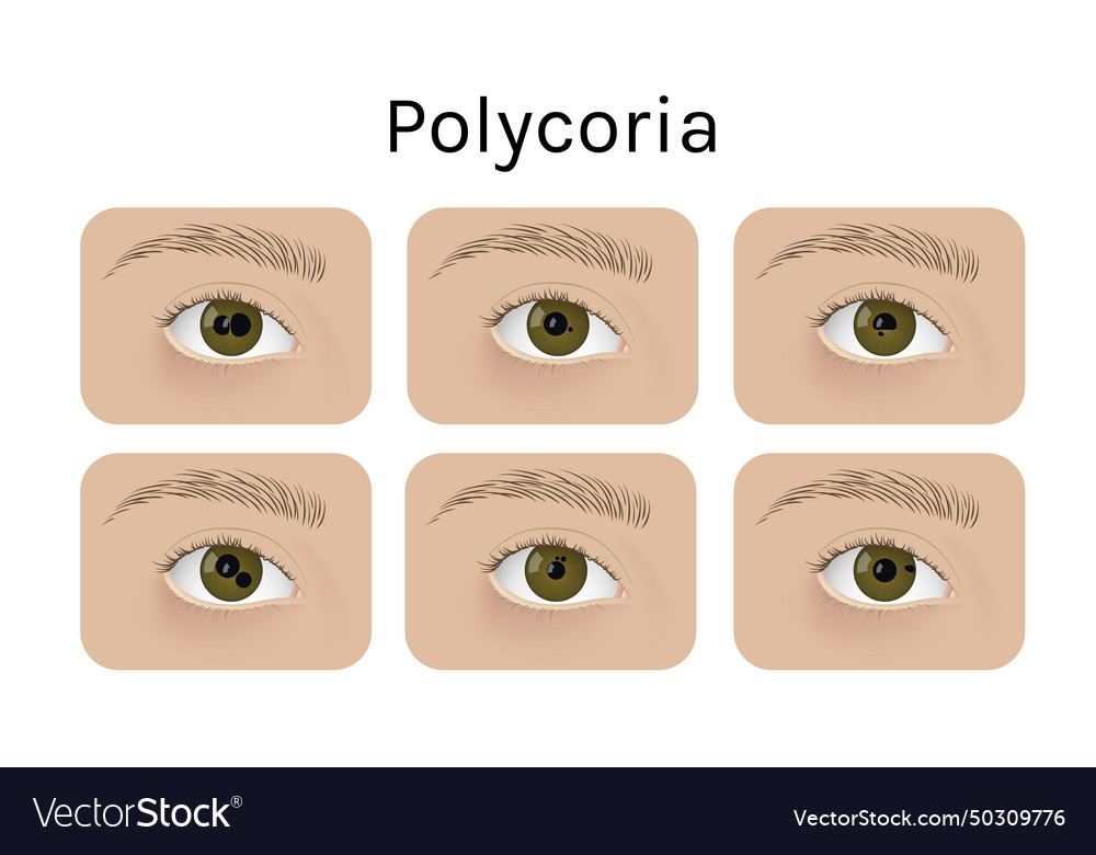 Realistic human eyes with polycoria Royalty Free Vector