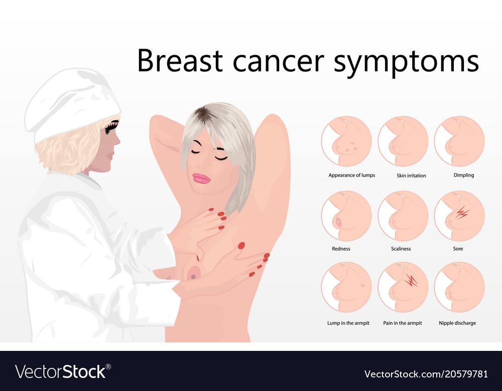 Is breast pain a sign of cancer?