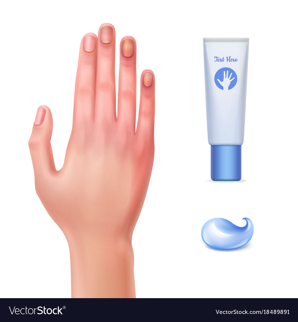 Gel from bruises Royalty Free Vector Image - VectorStock