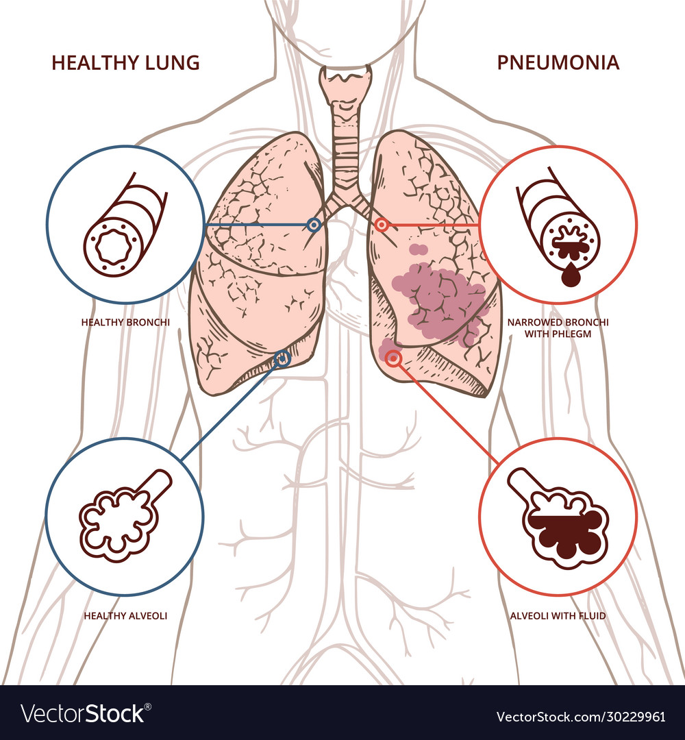 A schematic human body