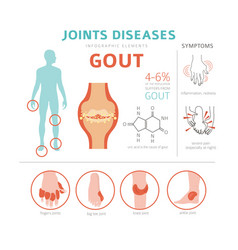 Joints diseases arthritis osteoarthritis symptoms Vector Image