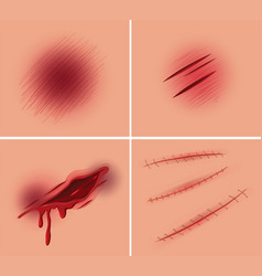 Wound Vector Images (over 11,000)