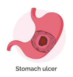 Gastroesophageal reflux disease stomach gerd Vector Image