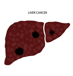 Liver disease concept Royalty Free Vector Image