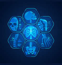 X-ray hand Royalty Free Vector Image - VectorStock