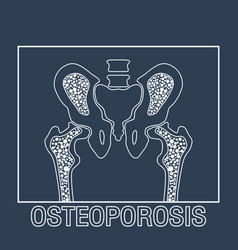 Osteoporosis logo icon design Royalty Free Vector Image