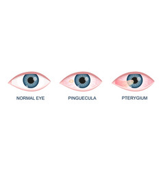 Diagram human eye anatomy with label Royalty Free Vector