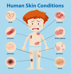 Diagram showing boy with different skin conditions