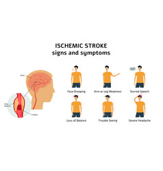 Ischemic heart disease ischemic cardiomyopathy Vector Image