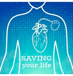 Heart pacemaker body Royalty Free Vector Image
