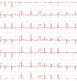 electrocardiogram red graph with marks on white vector image vector image