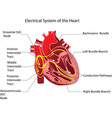 Vessels of the heart bypass surgery Royalty Free Vector