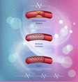 hearts cholesterol disease dealing method banner vector image vector image