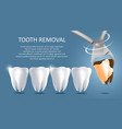 tooth removal medical poster banner vector image vector image