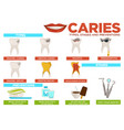 caries types stages and prevention poster vector image vector image