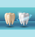 clean and dirty tooth before and after whitening vector image