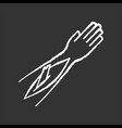 open bone fracture chalk white icon on black vector image vector image