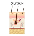 layers of oily skin vector image