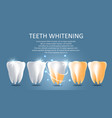 teeth whitening medical poster banner vector image vector image