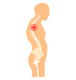 human figure with spine pain side view anatomy vector image vector image