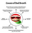 Causes Bad Breath Halitosis Structure Of Vector Image